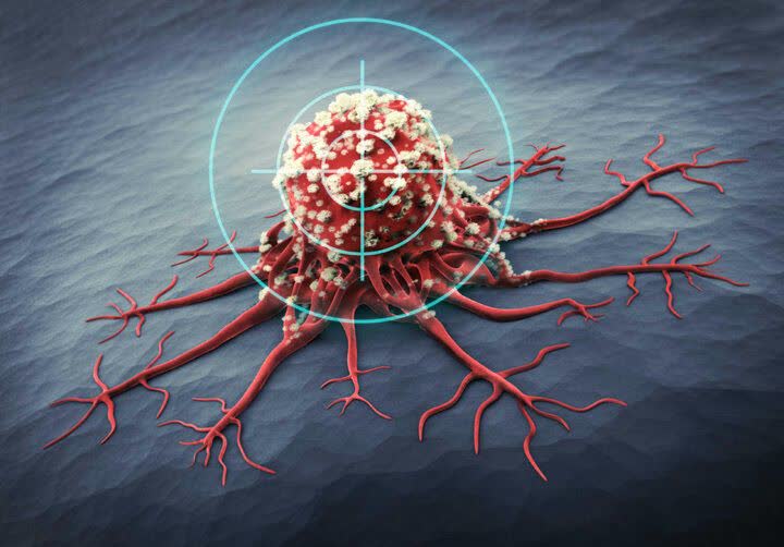 شیوع بالای سرطان‌های گوارش و پستان در کرمانشاه